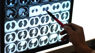 Image d'illustration.