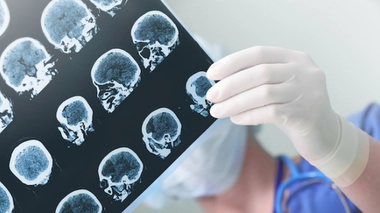 Image d'illustration.