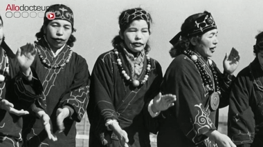 Le poil masculin et féminin : une longue histoire !