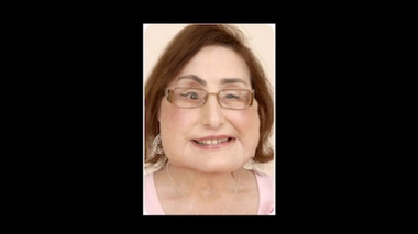Connie Culp : première américaine greffée du visage est morte à 57 ans.