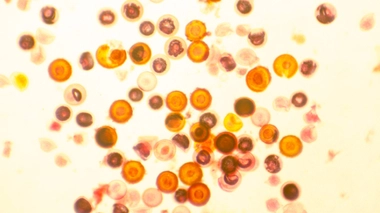 Image d'illustration. Oeufs de ténia du porc, dont l'ingestion peut provoquer un kyste dans le cerveau.