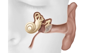 Selon des chercheurs, la covid pourrait provoquer une perte d'audition