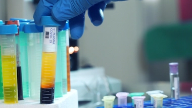 Image d'illustration.