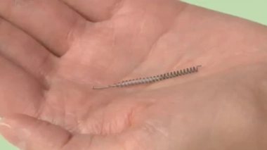 Contraception : un questionnaire ouvert à toutes les femmes pour estimer les risques de l'implant Essure