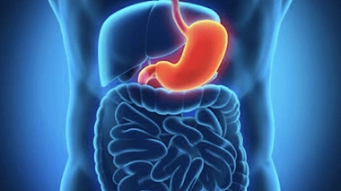 Cancer de l'estomac : quelle vie après la chirurgie ?