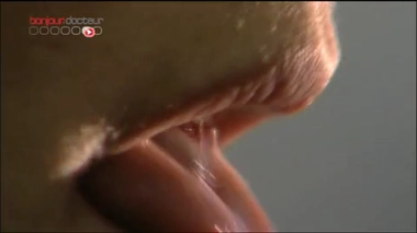 Cancer du poumon : un antidiabétique en préventif ?