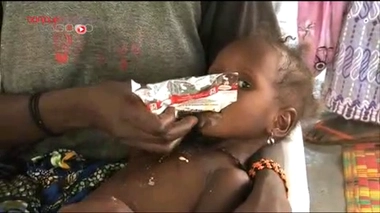 Malnutrition : le Plumpy-Nut à la rescousse !