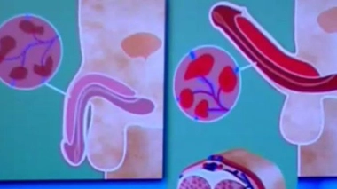 Ch@t : Ejaculation précoce