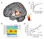 Les chercheurs ont réussi à décoder des mots sans paroles