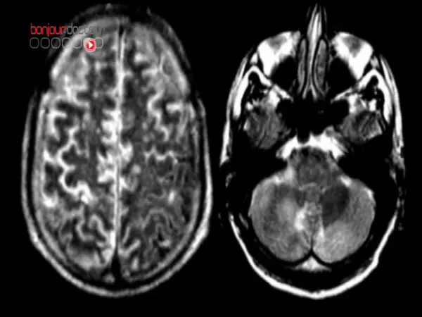 Le Bon, la Brute et le Truand pour explorer les fonctions cérébrales