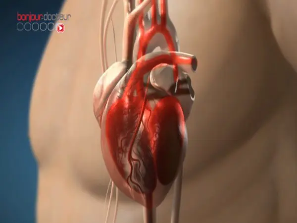 Maladie cardiaque : un facteur génétique chez l'homme ?