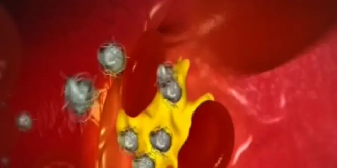 Comment le bon cholestérol se transforme-t-il en mauvais ?