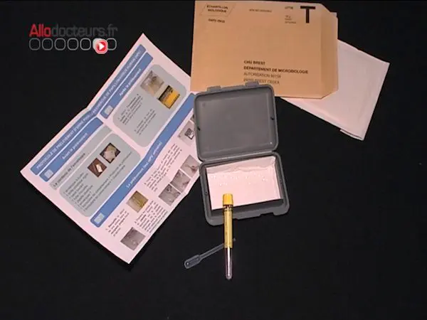 Expérimentation d'un test urinaire pour dépister le cancer du col de l'utérus