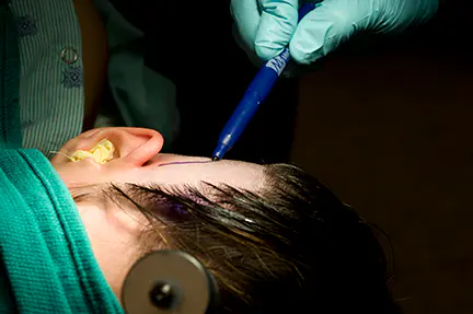 Début de l'opération par le Dr Dong Kim