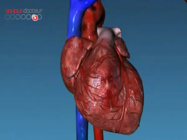 Baisse de la mortalité par infarctus en France