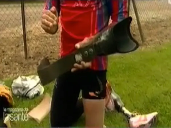 Une prothèse carbone