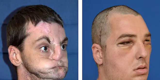 © University of Maryland Medical Center