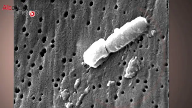 La bactérie Klebsiella pneumoniae multirésistante