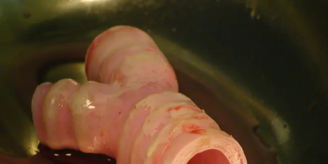 La section de trachée, quelques instants avant la greffe (source : Harvard Bioscience)