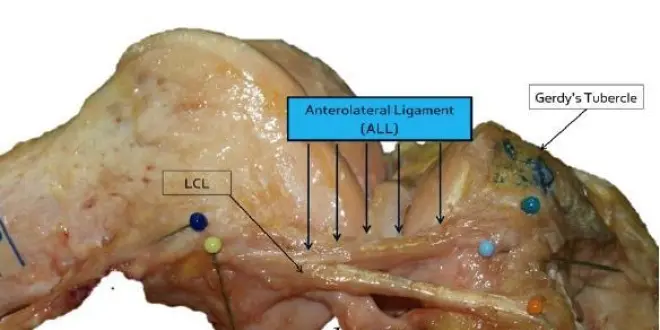Crédit photo: Université de Louvain