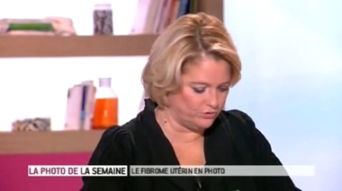 Le fibrome utérin expliqué en images