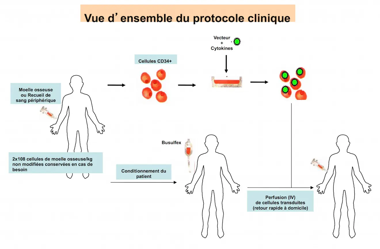 Schéma du protocole clinique (source : AFM-Téléthon)