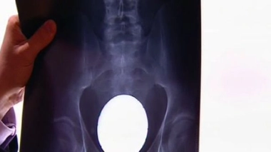 Les urgences du sexe