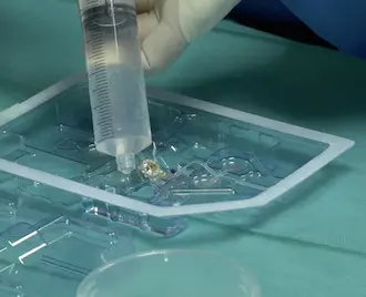 L'implant est placé dans une solution avant la pose. Copyright : Second Sight Medical Products Inc.