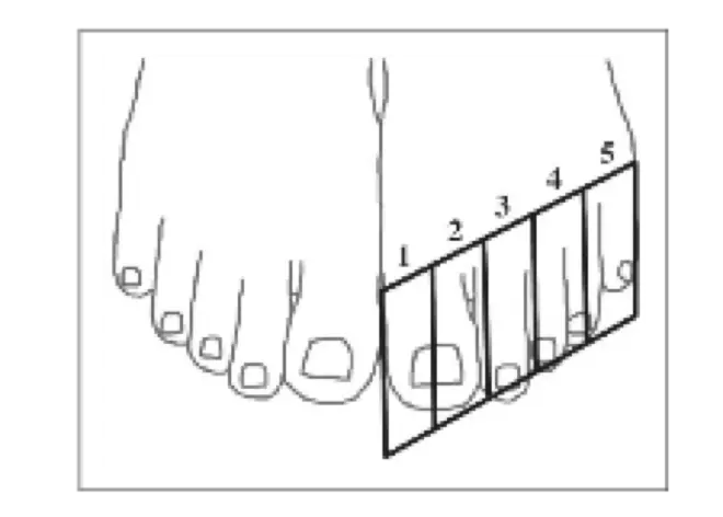 Notre gros orteil occupe deux cases au lieu d'une, si bien que les autres doigts de pied chevauchent les cases suivantes. 
