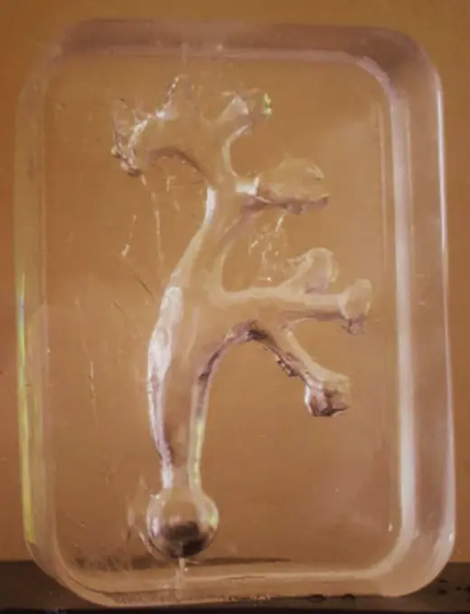 Le rein en silicone utilisé dans l'expérience. (DR)