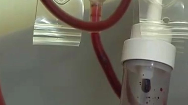 Un enfant sur 440 va developper un cancer avant l'âge de 15 ans