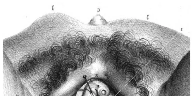 1834 Blandin - esquise des bulbes vestibulaires