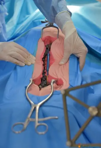 Dos et rachis de l’enfant reconstitués pour la simulation. (CHU Amiens)