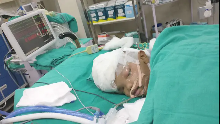 Un des deux enfants après l'opération