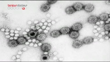 Epidémies : la gastro-entérite prend de l'ampleur