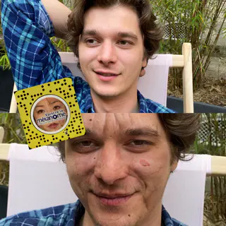 Le filtre ajoute des rides et des taches pour montrer l'action du soleil sur la peau.