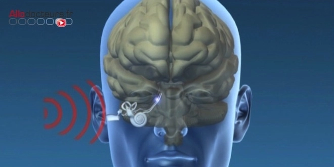 Le son, une source d'information et de stimulation pour le cerveau