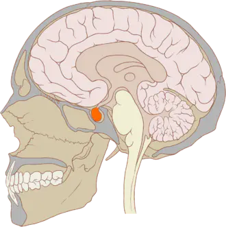 Localisation de l'hypophyse dans le cerveau (en orange). (Illustration : P.J. Lynch cc-by-sa)