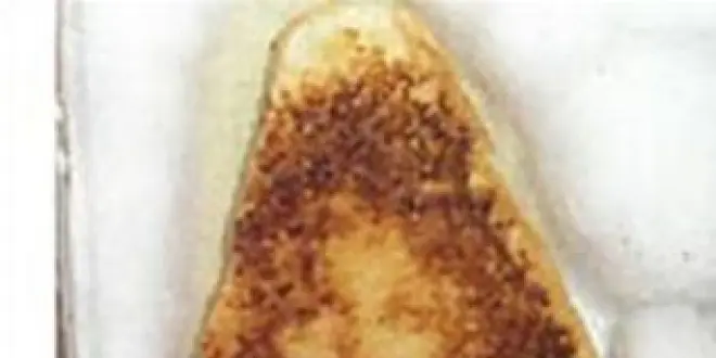 Le support d'étude des lauréats du prix de neurosciences. Le fait d'identifier une silhouette précise (ou les traits d'un visage) dans une forme générée aléatoirement porte le nom de paréidolie.