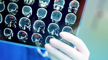 Image d'illustration.