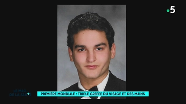 VIDEO - A New-York, une triple greffe permet à un homme de retrouver un visage