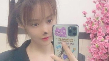 Une actrice chinoise défigurée après une opération du nez