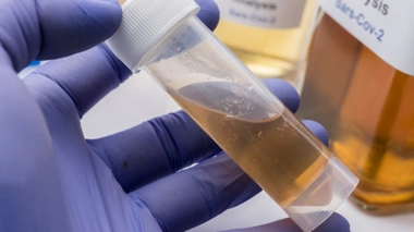 Image d'illustration. Analyse des eaux usées en laboratoire.