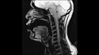 VIDEO - Que se passe-t-il à l'intérieur de la gorge d'un chanteur ? La réponse grâce à une IRM