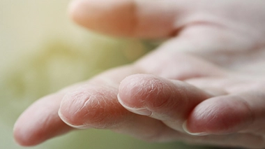 Image d'illustration.