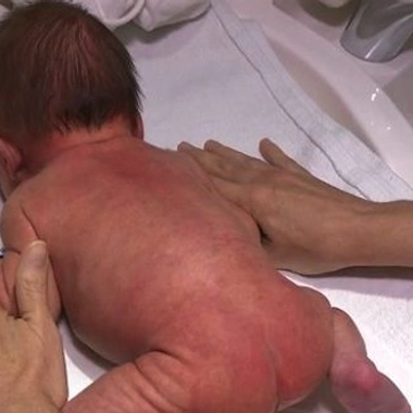 Mort subite du nourrisson : continuer la prévention