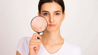 Problèmes de peau et imperfections 