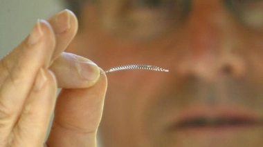 Implants Essure : des premiers effets secondaires aux premières plaintes au pénal, retour sur toute l'affaire