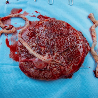 Placenta : un organe éphémère