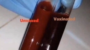 Les anti vaccins comparent de faux échantillons de sang vacciné et non vacciné
